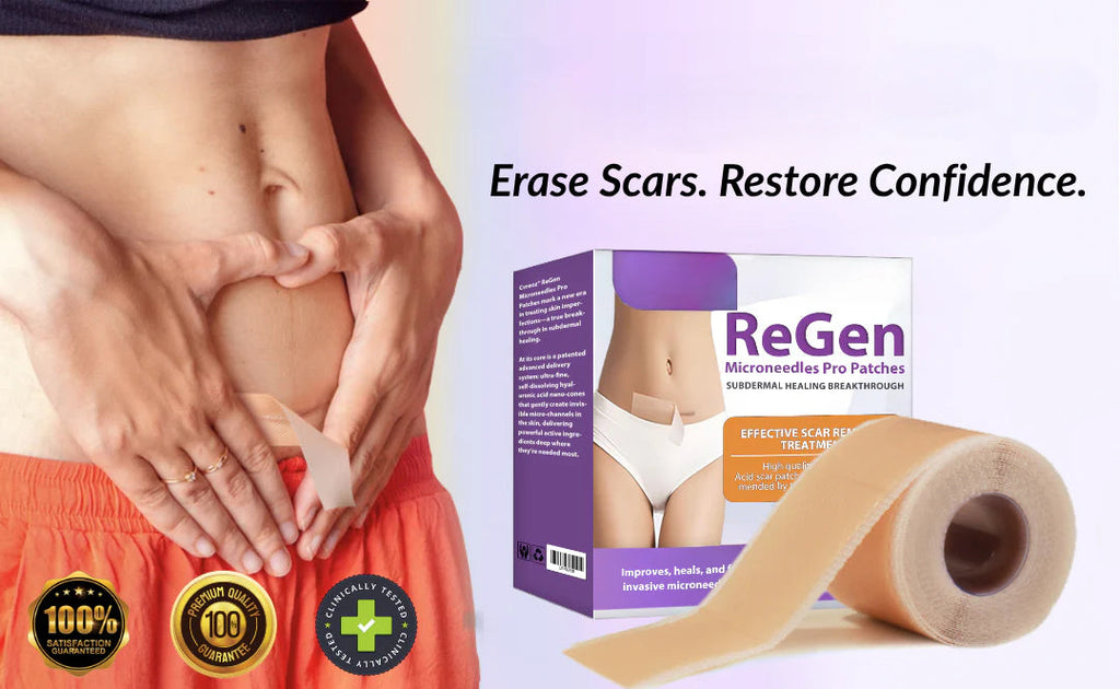 Official Store: ReGen Microneedles Pro Patches with Hyaluronic Acid Nano-Heal Treatment for new and old scars, reduction of surgical scars, stretch marks, keloids, acne, burns, warts, dermatomas, and varicose veins