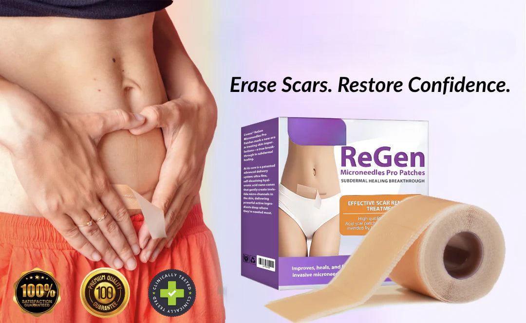 Official Store: ReGen Microneedles Pro Patches with Hyaluronic Acid Nano-Heal Treatment for new and old scars, reduction of surgical scars, stretch marks, keloids, acne, burns, warts, dermatomas, and varicose veins